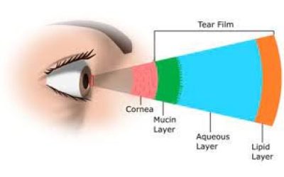 Penyakit Mata Kering (Dry Eye Disease): Definisi, Gejala, Penyebab, Pengobatan