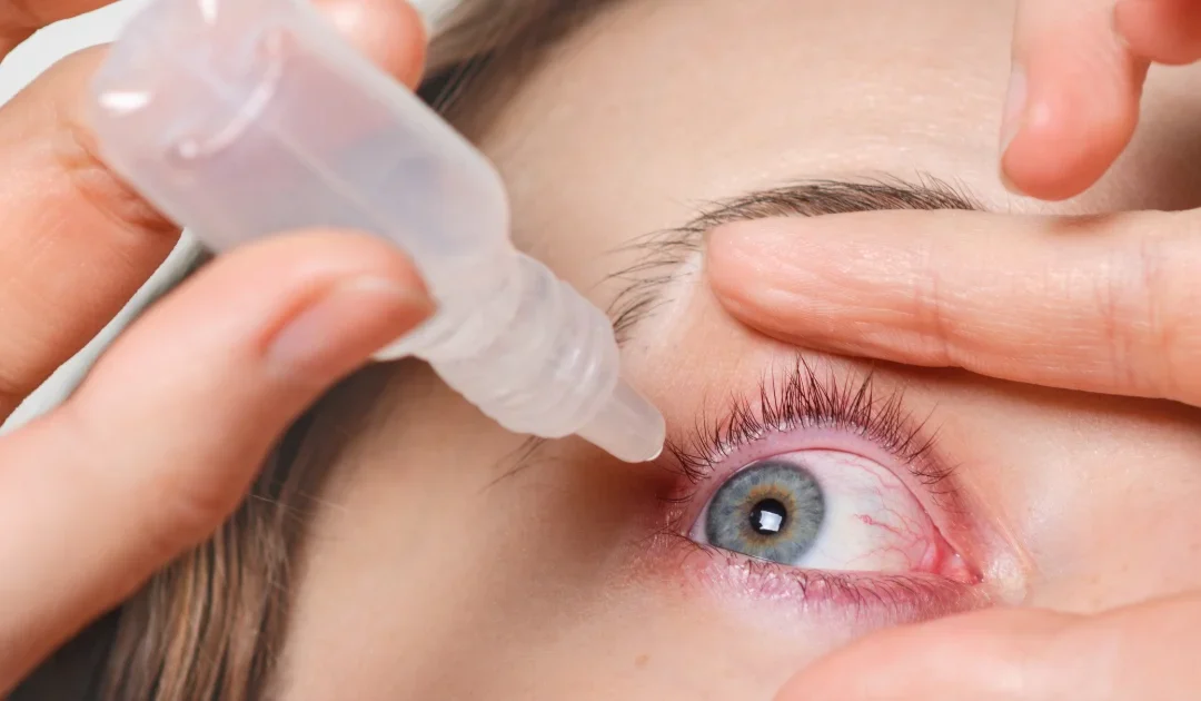 tips setelah operasi LASIK